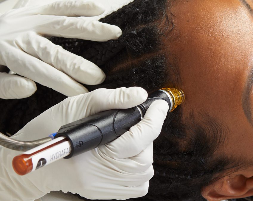 Express Facials for Acne-Prone Skin: Say Goodbye to Breakouts