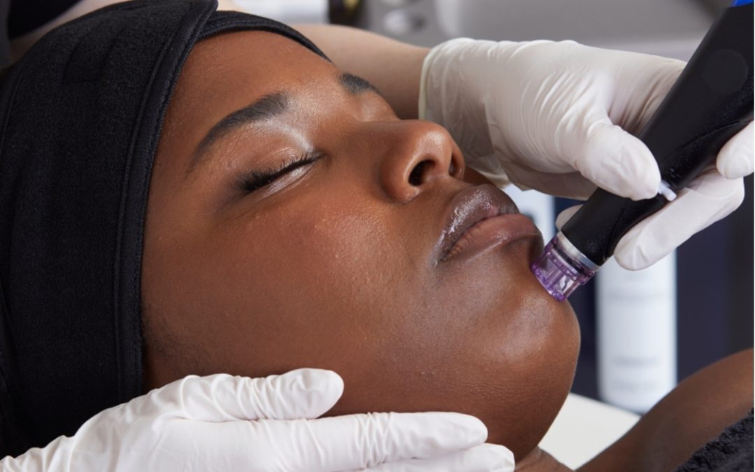 Top Professional Treatments for Dehydrated Skin