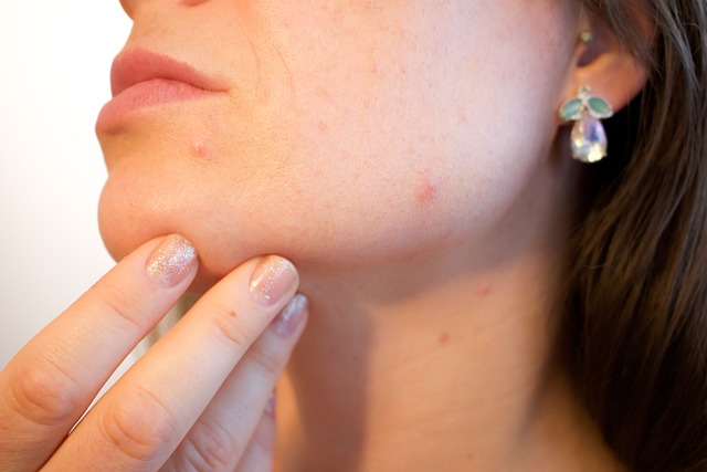 Who Should Consider Dermaplaning for Acne Scars and Why?