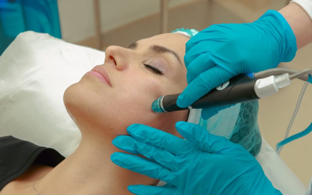 How Often Should You Dermaplane to Keep Peach Fuzz and Dead Skin Away?