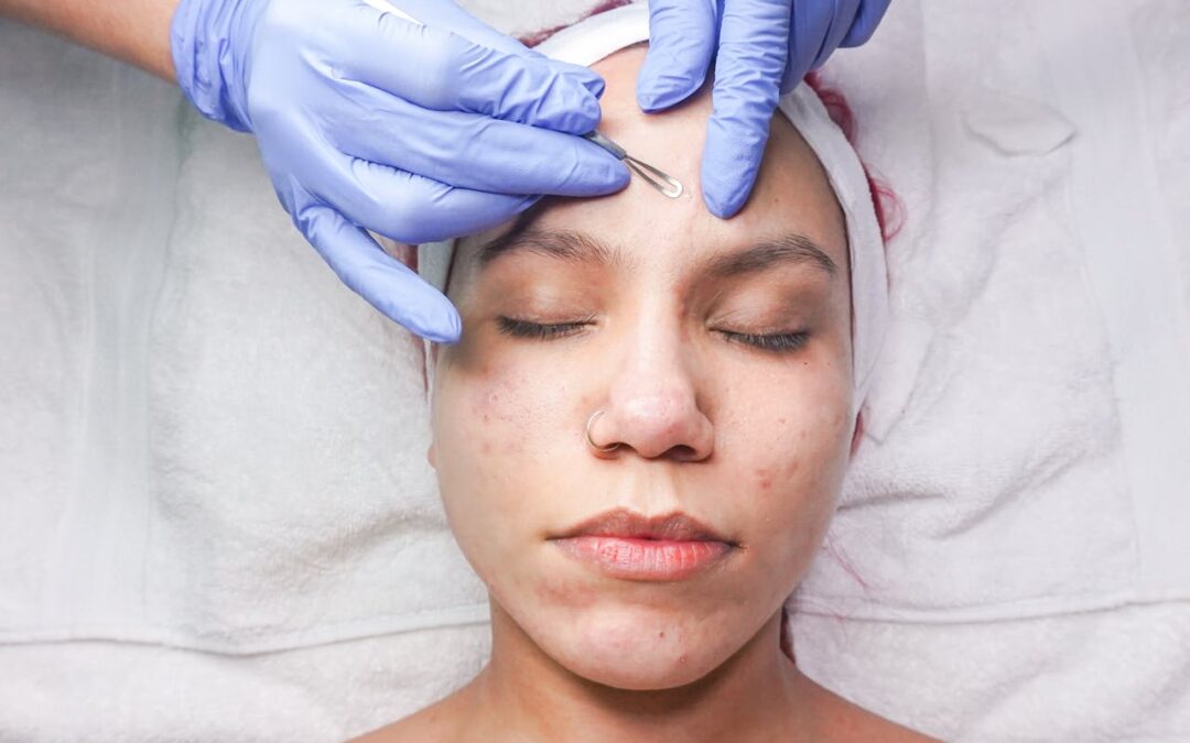 Acne-Focused Facial Treatments